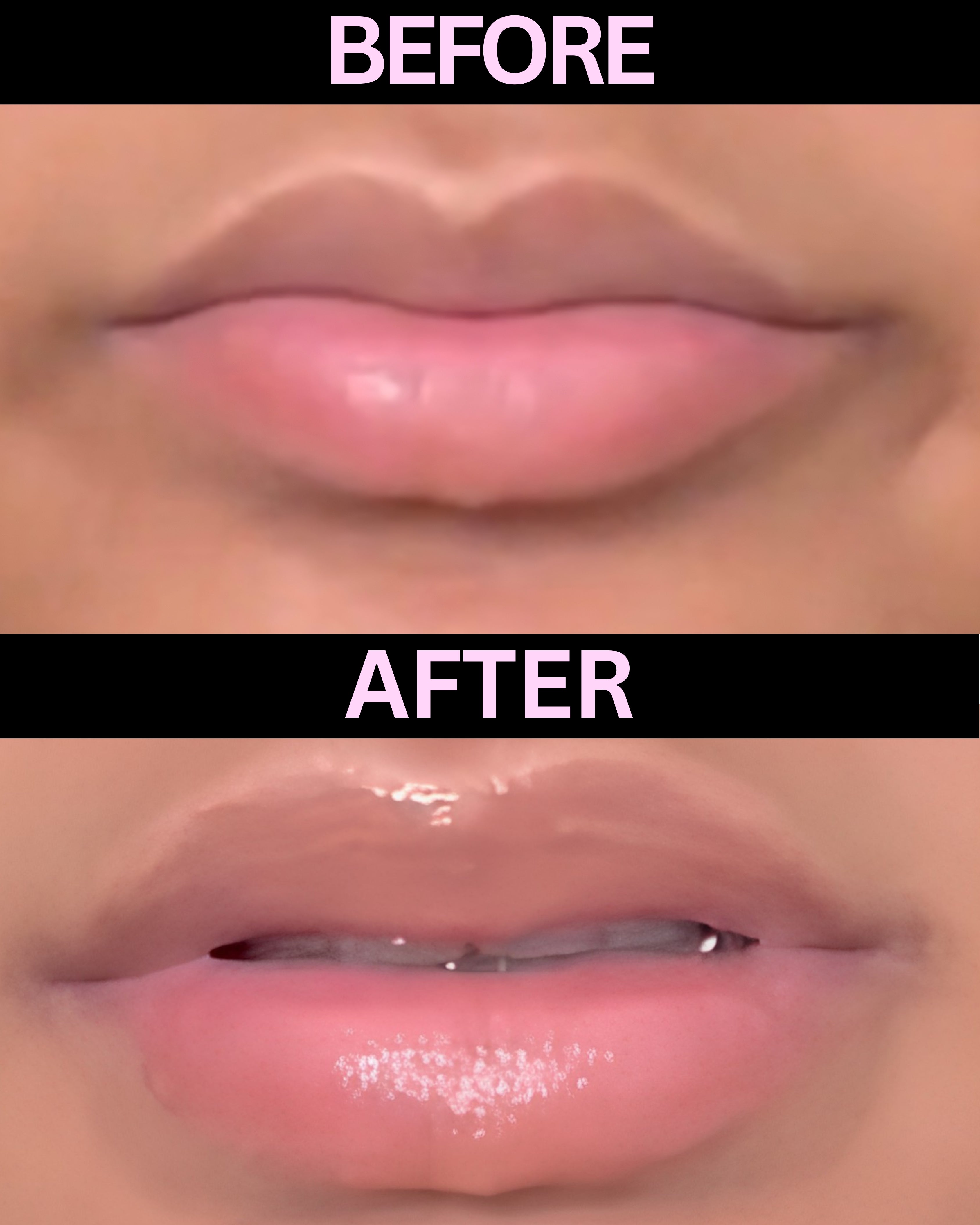 Hazel Extreme Lip Plumper